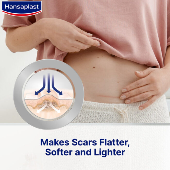 hansaplast scar reducer xl self adhesive patches